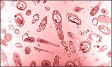 Bacillus permians